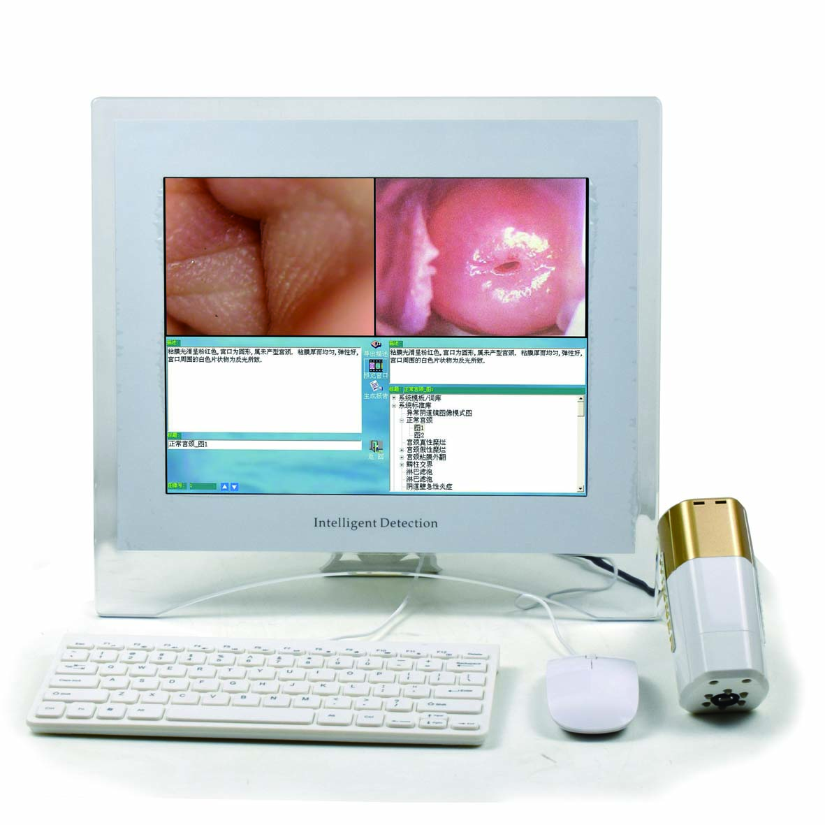 妇科电子阴道镜检测仪,妇科内窥镜