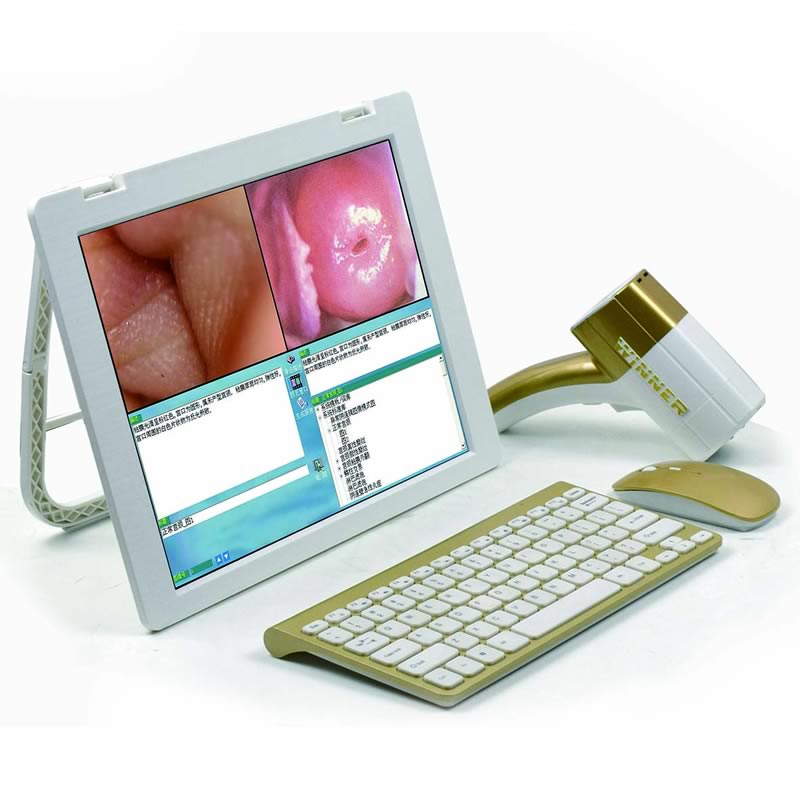 妇科电子阴道镜检测仪B6型